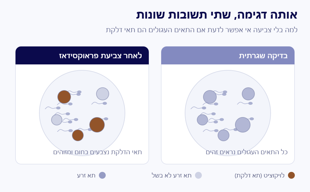 השוואה בין בדיקת זרע שגרתית לצביעת פראוקסידאז לזיהוי לויקוציטים בזרע