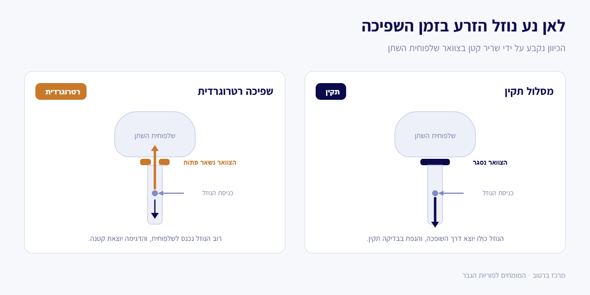 השוואה בין מסלול שפיכה תקין לשפיכה רטרוגרדית שגורמת לנפח זרע נמוך